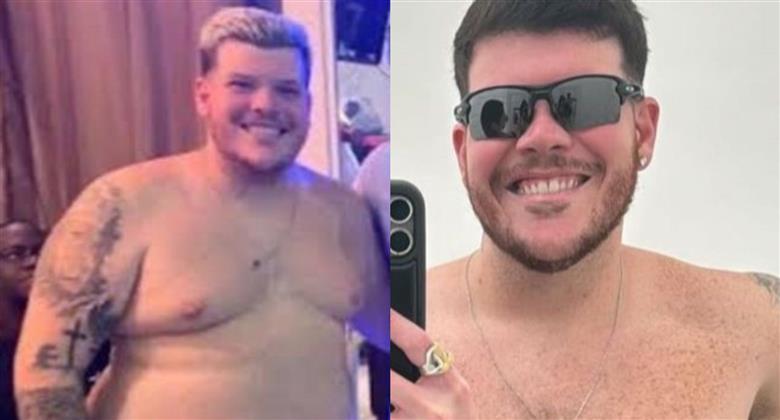 Ferrugem chama atenção ao aparecer sem camisa após perder 33 kg veja