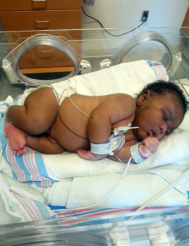 Em parto normal, mulher dá à luz bebê com mais de cinco quilos
