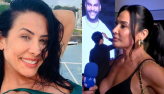 Scheila Carvalho abre o jogo quando percebeu problema no rosto