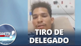 Ambulante tem perna amputada aps tiro de delegado
