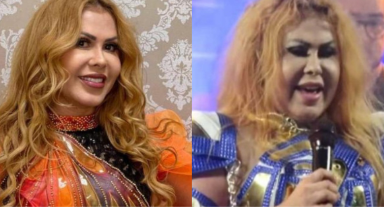 Joelma Surge Rosto Inchado Em Show E Deixa F S Preocupados Redetv