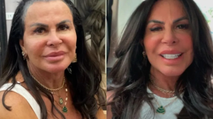 Gretchen mostra novo visual após crise capilar: "PERDI TODO O CABELO"