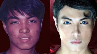 Filipino passa por mais de 20 cirurgias para se transformar em 'Super-Homem'