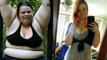 Ex-obesa mostra lado obscuro da perda de peso com fotos sinceras