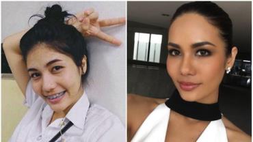 Miss Tailândia garante que dicas simples a levaram de garota nerd à modelo internacional em seis meses
