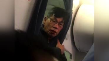 Vídeo mostra passageiro sangrando após ser agredido e arrastado para fora de voo nos EUA