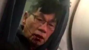 Médico que foi arrastado para fora voo da United Airlines chega a acordo com a empresa