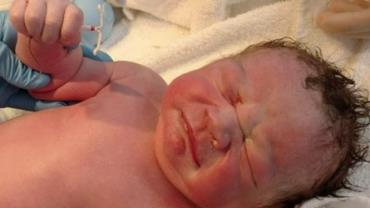 Foto que mostra bebê recém-nascido segurando DIU viraliza na web