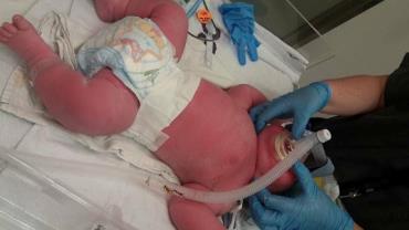 Mulher dá à luz bebê de 7,4 quilos e 57 centímetros na Nova Zelândia