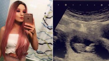 Mulher interrompe gravidez após descobrir câncer: "Era a minha vida ou a do bebê"