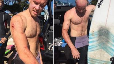Surfista sobrevive a ataque de tubarão após dar soco no animal