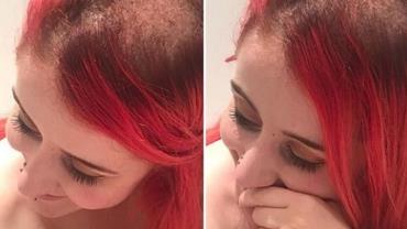 Blogueira desabafa sobre perder cabelo após quimioterapia: "Não me define"