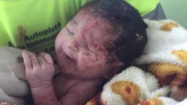 Bebê nasce após mãe ter barriga rompida ao ser arremessada de caminhão em SP