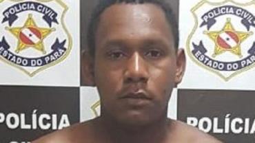 Homem é preso após decepar dedos das mãos de cunhado no Pará