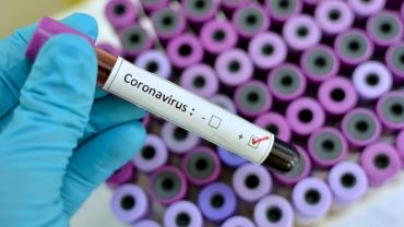 Brasil tem 486 mortes e 11.130 casos confirmados de coronavírus, diz Ministério da Saúde