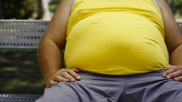 Coronavírus: Obesidade é o fator de risco mais relacionado à morte de jovens