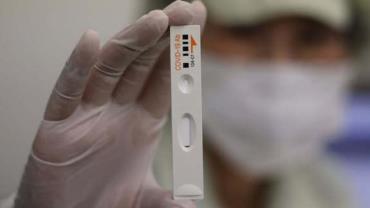 Pesquisadores desenvolvem testes rápidos para detectar coronavírus