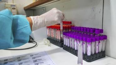Estado confirma dois casos da nova variante do coronavírus em São Paulo