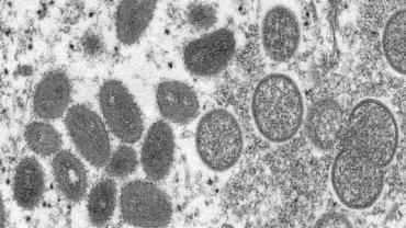 Rio de Janeiro investiga cinco casos de varíola dos macacos