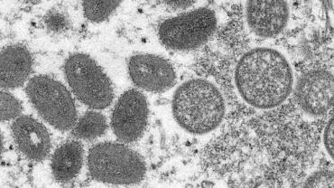 Ministério investe R$ 3 milhões em pesquisas sobre varíola dos macacos