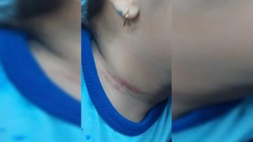 Menina de 4 anos relata agressão de professora e caso vai parar na polícia: "Eu chorei"