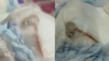 VÍDEO: mãe encontra rato em fralda de filho de apenas um mês de vida