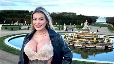 Andressa Urach desembolsa R$ 40 mil e faz nova modificação no rosto; veja