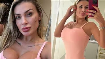 Andressa Urach passa por nova transformação e realiza procedimento de rejuvenescimento íntimo