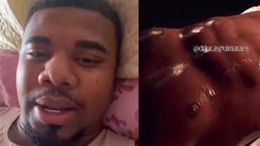 Ex-BBB Davi Brito publica fotos e mostra resultado da lipo HD: "Estou bem"