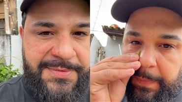 Cantor sofre acidente e recebe chamas no rosto durante show em São Paulo