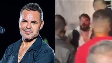 Cantor diz ter sido agredido por produtor de Eduardo Costa e dispara: "Covarde"