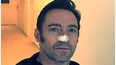 Hugh Jackman tranquiliza fãs após anunciar nova luta contra câncer de pele: "Quase curado"