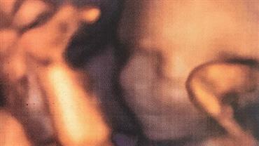 Grávida, Eliana posta primeira imagem de ultrassonografia da filha