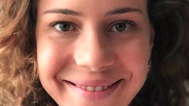 Leandra Leal remove pinta que tinha no canto da boca