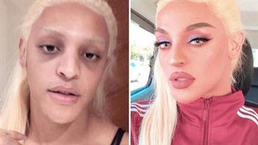 Pabllo Vittar choca internautas ao mostrar antes e depois de transformação
