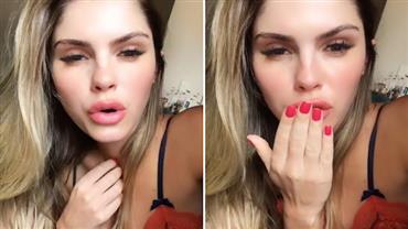 Bárbara Evans surge em vídeo com a boca inchada após procedimento estético