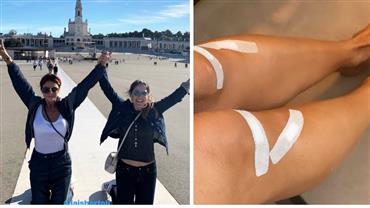 Giovanna Antonelli mostra joelhos machucados após pagar promessa