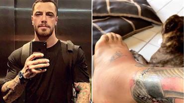 Felipe Titto tem infecção na perna após mordida de cachorro: "Começou a ficar inchada"