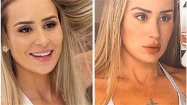 Ex-BBB Letícia Santiago mostra antes e depois de cirurgia no nariz e cutuca familiares