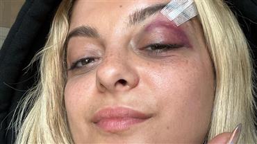 Bebe Rexha é atingida por celular durante show e é hospitalizada