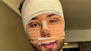 Rico Melquiades revela quanto gastou em cirurgias plásticas no rosto